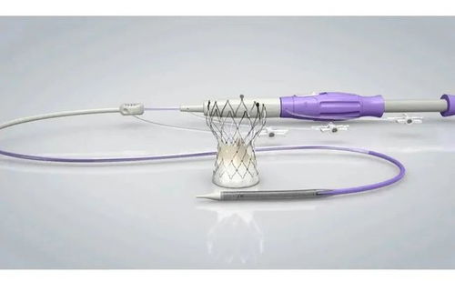 2021年園區(qū)5款創(chuàng)新醫(yī)療器械產(chǎn)品獲批上市，占全省71%